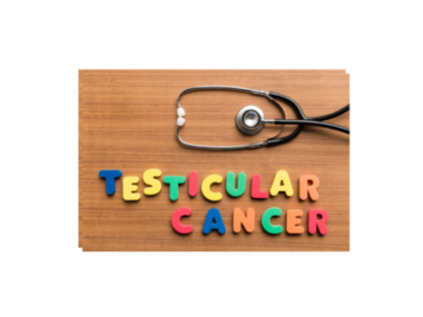 All about Testicular Cancer and can it Cause Infertility